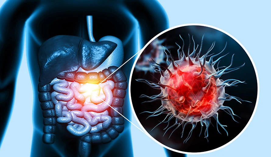 Understanding Cancer Risk and the Most Common Cancers